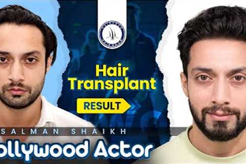Celebrity Hair Transplants: Salman Shaikh's Results | Hairfree & Hairgrow #hairtransformation