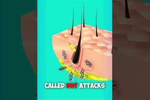 Why Hair Loss? Explained with 3d Animation. #shorts #animation #hair #education