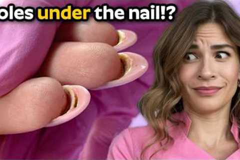 Dark spots and HOLES in the nail extensions!?