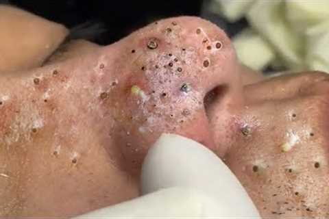 𝙍𝙚𝙡𝙖𝙭𝙞𝙣𝙜 𝙎𝙠𝙞𝙣𝙘𝙖𝙧𝙚 𝙍𝙤𝙪𝙩𝙞𝙣𝙚 𝘾𝙡𝙚𝙖𝙣𝙨𝙞𝙣𝙜 𝙛𝙤𝙧 𝙖 𝙋𝙚𝙖𝙘𝙚𝙛𝙪𝙡..