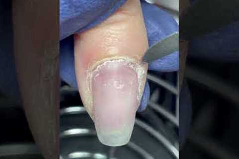 Don’t ever get confused again! #nailcare #naturalnails #nailtipsandtricks #nailanatomy #cuticles