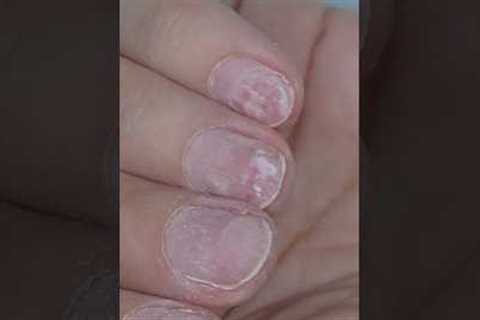 Tissue- thin nails 🤧 How to fix it ? #nails #nailtutorial #gelmanicure