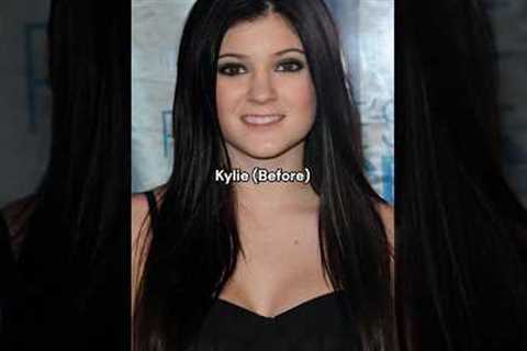 The Kardashians before surgery. #kendalljenner #kardashians #hollywood #usa #newyork #kimkardashian