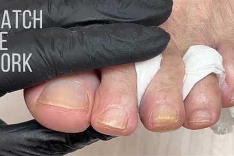 Watch me work and explain dry pedicure.