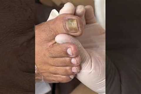 🎄1Cuticle removal-cleaning manicure.luizza