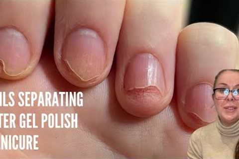 Nails separating after gel polish [Nail Technician explains]