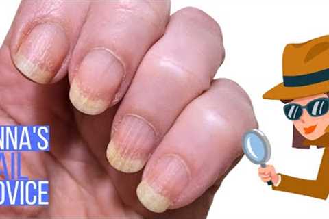 Yellow and dry nails when not wearing polish [Anna's Nail Advice]