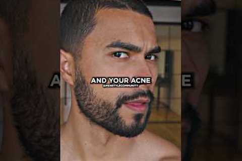 Jose Zuniga on How To Get Rid Off Pimple