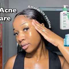 SKINCARE ROUTINE FOR OILY ACNE-PRONE SKIN | A routine for smooth & clear Skin ‼️