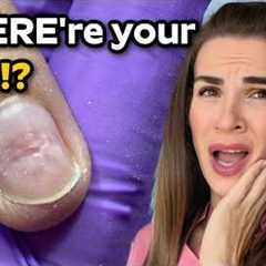 She ripped off her nail extensions...