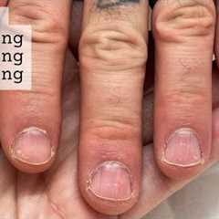 How to re-start your nails (after falling off the wagon) WEEK 1