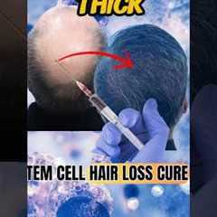 Stem Cell Hair Loss Cure?