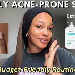 A simple oily acne-prone skincare routine | For smoother & clearer skin