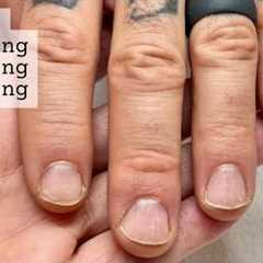 Restarting your nails [after falling off the wagon] WEEK 1