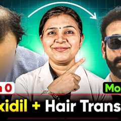Minoxidil + Hair Growth Time Lapse | Best Hair Transplant Results in India | Hair Growth