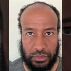 1 Year Afro Hair Transplant Turkey Results #shorts #hairtransplant #hairtransplantturkey