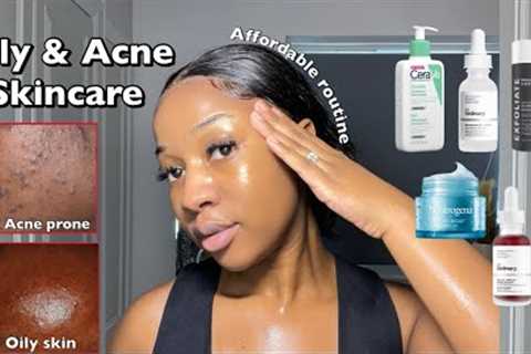 SKINCARE ROUTINE FOR OILY ACNE-PRONE SKIN | A routine for smooth &amp; clear Skin ‼️