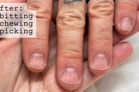 How to re-start your nails (after falling off the wagon) WEEK 1