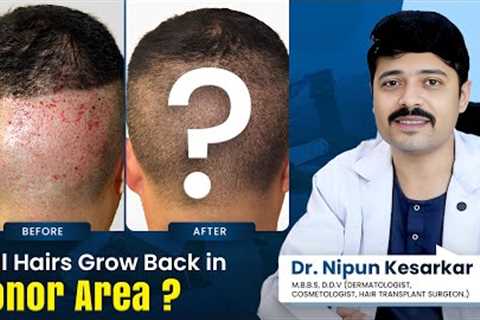 Donor Area Recovery: Will Hair Regrow After My Hair Transplant? Dr. Nipun Answers #hairtransplant