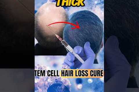 Stem Cell Hair Loss Cure?