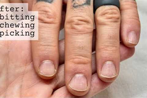 Restarting your nails [after falling off the wagon] WEEK 1