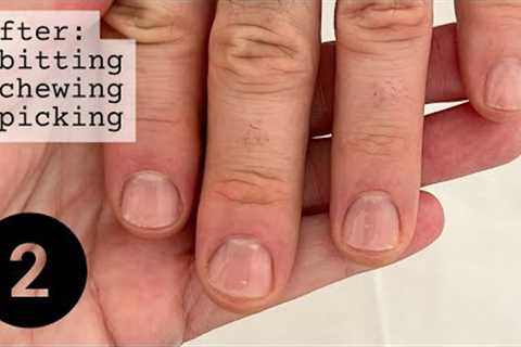 How to re-start your nails (after falling off the wagon) WEEK 2
