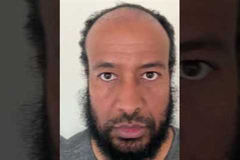 1 Year Afro Hair Transplant Turkey Results #shorts #hairtransplant #hairtransplantturkey