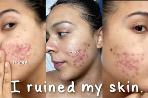 I Ruined My Skin with this Beauty Hack... #shorts #skincare