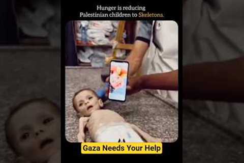 GAZA CHILDREN REDUCED TO SKELETON DUE TO CRISIS #shorts#viral #trendingnow #gazachildren #gazacrisis