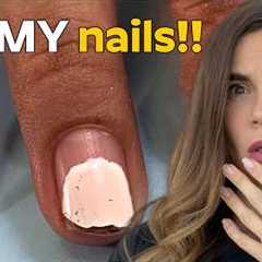 42-Day Old Gel Manicure Rescue