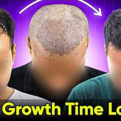 Hair Growth Time Lapse - 5 Months Hair Transplant Before & After | Hair Transplant Results #hair