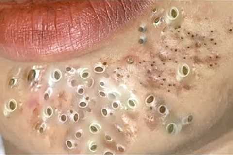 𝙍𝙚𝙡𝙖𝙭𝙞𝙣𝙜 𝙎𝙠𝙞𝙣𝙘𝙖𝙧𝙚 𝙍𝙤𝙪𝙩𝙞𝙣𝙚 𝘾𝙡𝙚𝙖𝙣𝙨𝙞𝙣𝙜 𝙛𝙤𝙧 𝙖 𝙋𝙚𝙖𝙘𝙚𝙛𝙪𝙡..