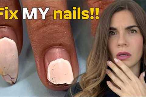 42-Day Old Gel Manicure Rescue