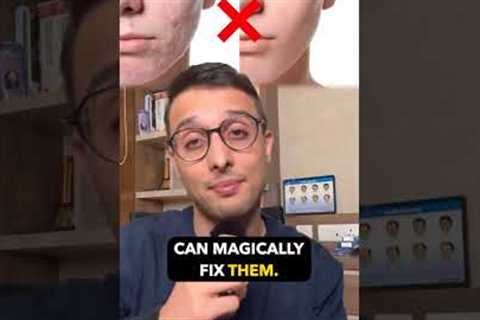 How to Get Rid of Acne Scars: Top Treatments That Work! | Dr. Sarin |
