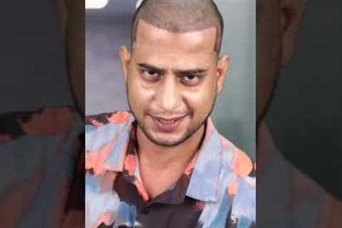 YouTuber Mehtab Saifi Hair Transplant Journey