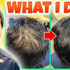 How I Treated My Thinning Hair the Holistic Way!
