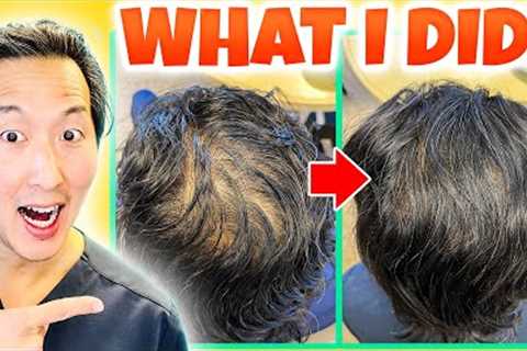 How I Treated My Thinning Hair the Holistic Way!