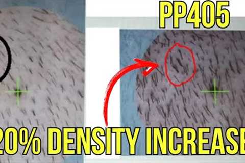 PP405 HAIR LOSS BREAKTHROUGH? PELAGE GROWS HAIR 20% IN 4 WEEKS!