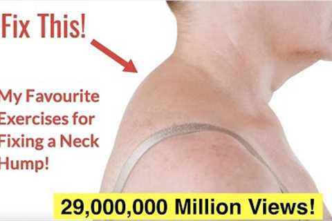 How to Fix a Neck Hump at Home (FAST) | With FREE Exercise Sheet!