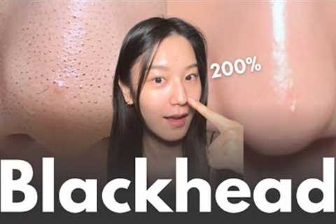 How to really remove blackheads at home in 7 days (+No matter your skin type)