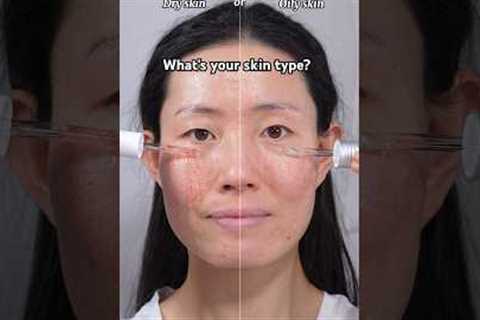 Do you have Dry skin or Oily skin? Anua serums, moisturizer, Dr Althea 345 cream #skincareroutine
