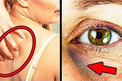 30 HEALTH HACKS EVERYONE SHOULD KNOW