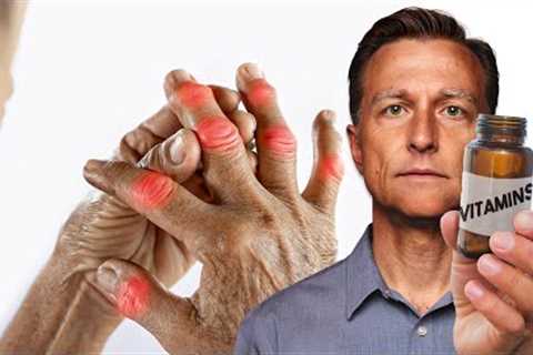 The #1 Best Vitamin for Arthritis (NOT VITAMIN D)