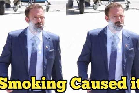 Shocking Revelation: Ben Affleck’s Chronic Cancer Linked to Years of Heavy Smoking