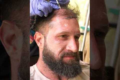 This SAVED my Hair!  #stemcells #hairloss #hairgrowth