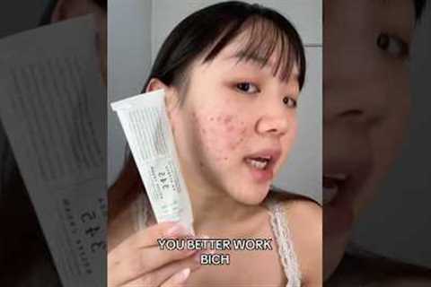 Is 345 cream worth it? 🥴YesStyle code: GRACE888 to get $$ off 🙂‍↕️#skincare #kbeauty #acne
