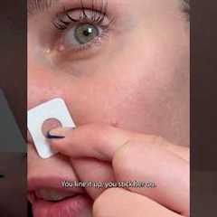 How An Esthetician Gets Rid Of A Pimple In 1 Day!! Zitsticka Killa Patch #zitsticka #acne #skincare