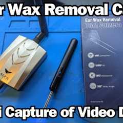 IoT Ear Wax Removal Camera - WiFi Capture of Video Data