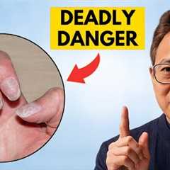 13 Hidden Signs Your Body Lacks Nutrients