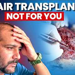 Stop! Don’t Get a Hair Transplant Until You See This